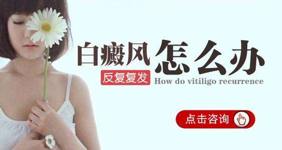 临沂有没有好的治疗白癜风的医院 