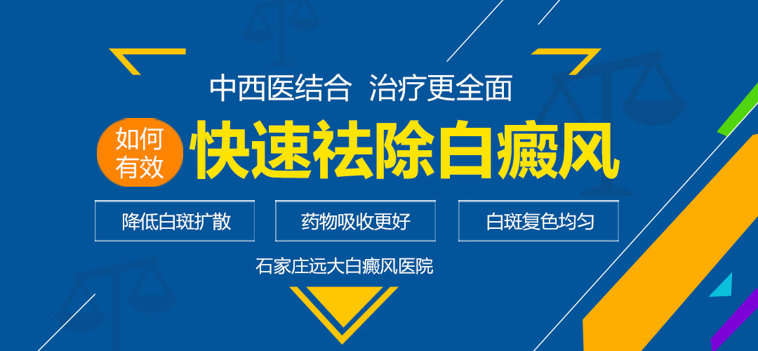 轻度白癜风用什么方法治疗比较好