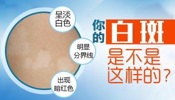 白癜风会先发红吗都有什么症状